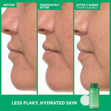 Green Tea Supercharged Set for Hydration & Skin Barrier Support