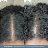 Scalp Revival™ Moisture + Detox + Refresh Minis Kit for Dry, Flaky Scalp