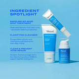 Clear Skin Acne Discovery Kit