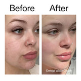 Target + Treat Breakouts Kit