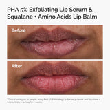 PHA 5% Exfoliating Lip Serum