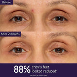 Premier Cru Target All Signs of Aging Gift Set for Fine Lines and Wrinkles