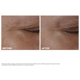 Anti Aging Skincare Essentials Set