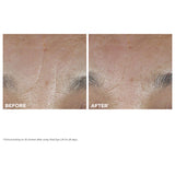 Anti Aging Skincare Essentials Set