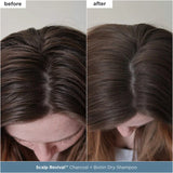 Scalp Revival™ Moisture + Detox + Refresh Minis Kit for Dry, Flaky Scalp
