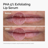 PHA 5% Exfoliating Lip Serum