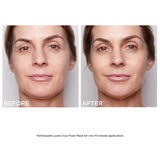 Prep & Recover Face Mask Set