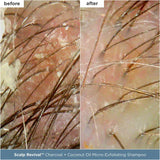 Scalp Revival™ Moisture + Detox + Refresh Minis Kit for Dry, Flaky Scalp