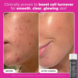 Plump & Glow 3-Step Kit for Clear, Firm Skin