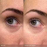 Faded Brightening Bundle for Discoloration on Face & Body