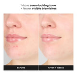 Skin Perfecting 1% BHA Gentle Exfoliating Gel Toner for Sensitive Skin