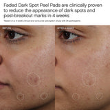 Faded Dark Spot Kit Gift Set