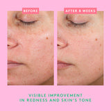 Moisture Everlasting: Bora Barrier Refill Kit