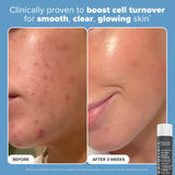 Mini Must-Haves with 2% BHA Exfoliating Toner, Foaming Cleanser, & SPF 50