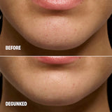 The POREfessional Degunker Blackhead & Pore Cleansing Mask System