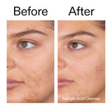 Target + Treat Breakouts Kit