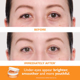 Full-Size Vitamin C & Hyaluronic Acid Eye Patches 2-Piece Gift Set