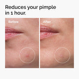 Sulfur 10% Powder-to-Cream Concentrate Acne Spot Treatment