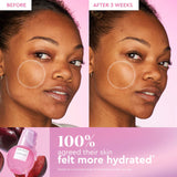 Plum Plump Deep Hydration Skincare Gift Set