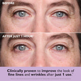 Instant FIRMx® Collagen Infusion Tightening Eye Patches for Firming Under-Eye Bags & Wrinkles