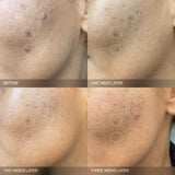 Faded Brightening Bundle for Discoloration on Face & Body