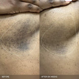 Faded Brightening Bundle for Discoloration on Face & Body