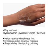 Target + Treat Breakouts Kit