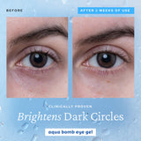 Aqua Bomb Hydrating Eye & Moisturizer Duo Set