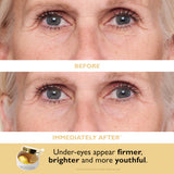 Patch + Go Eye Patch Travel Set for Hydrating & Firming