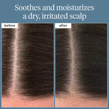 Scalp Revival™ Rosemary Pre-Wash Scalp and Hair Oil