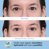 Full-Size Vitamin C & Hyaluronic Acid Eye Patches 2-Piece Gift Set