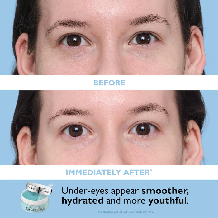 Full-Size Vitamin C & Hyaluronic Acid Eye Patches 2-Piece Gift Set