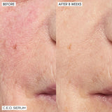 Home+ Away Brighten, Revitalize + Glow with CEO 15% Vitamin C Serum