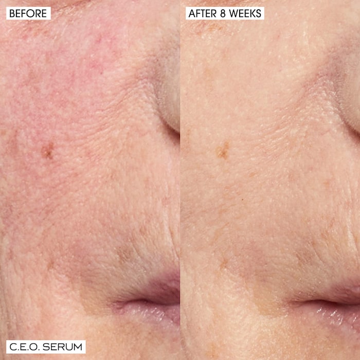 Home+ Away Brighten, Revitalize + Glow with CEO 15% Vitamin C Serum