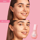 Glow & Go Summer Essentials Kit with Niacinamide