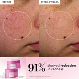 PDRN Repair + Soothe Korean Prickly Pear Toner Pads for Skin Barrier Repair