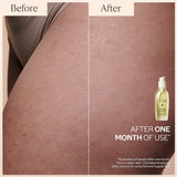 Almond Forever Hand & Body Gift Set