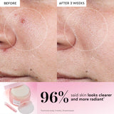 LHA + AHA Korean Watermelon Toner Pads for Hydration and Gentle Exfoliation