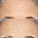 Home+ Away Brighten, Revitalize + Glow with CEO 15% Vitamin C Serum