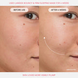 Bouncy Skin On the Go Set for Plumping and Firming