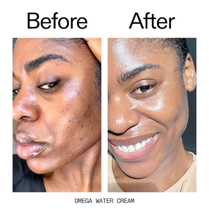 It's Giving Hydration Set