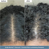 Healthy Hair Delights Gift Set for Scalp-to-Strand Care