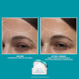 Full-Size Peptide Skinjection™ 2-Piece Skincare Set with Under-Eye Cream and Moisturizer