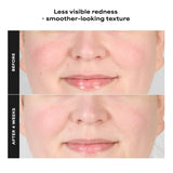 Skin Perfecting 1% BHA Gentle Exfoliating Gel Toner for Sensitive Skin