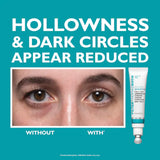 Full-Size Peptide Skinjection™ 2-Piece Skincare Set with Under-Eye Cream and Moisturizer