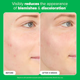 Complexion Clarity Duo with Salicylic Acid & Azelaic Acid