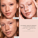 Clinical Skin Treats Set