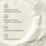 Sulfur 10% Powder-to-Cream Concentrate Acne Spot Treatment