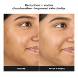 Skin Perfecting 1% BHA Gentle Exfoliating Gel Toner for Sensitive Skin