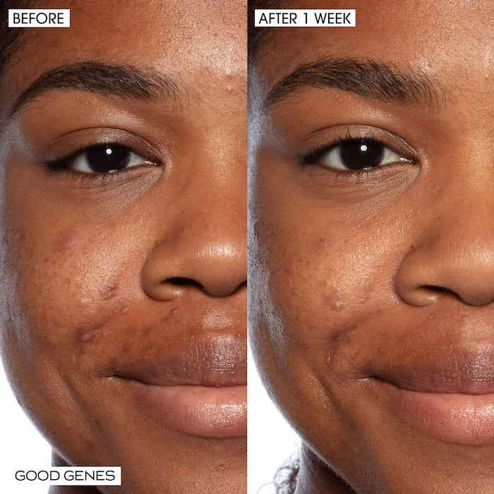 DEEP DIVE HYDRATION + PLUMPING SET FEATURING LIMITED EDITION GOOD GENES + NEW TIDAL DEEP